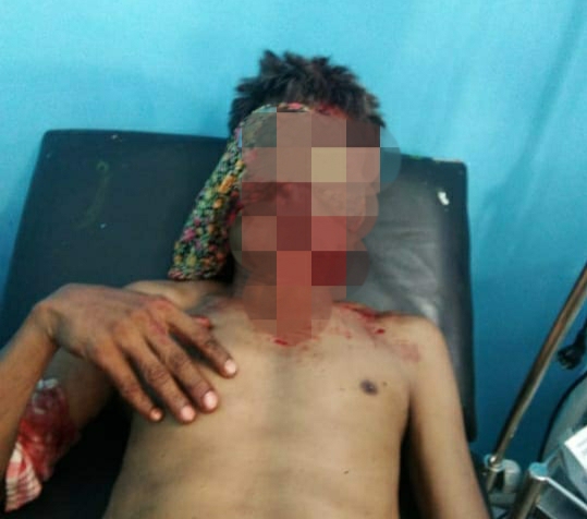 Diduga Pelakunya Beruang Pasutri Ditemukan Bersimbah Darah